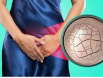 Nguyên nhân nào gây khô hạn ở phụ nữ trẻ tuổi? Làm sao để khắc phục?